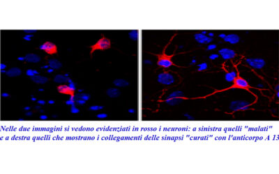 Alzheimer: scoperto all’EBRI l’anticorpo A13 che “cura” i neuroni e ringiovanisce il cervello