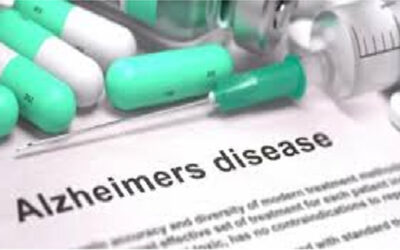 La ricerca sta abbandonando gli studi per i farmaci contro l’Alzheimer, sperimentazioni diminuite del 90%